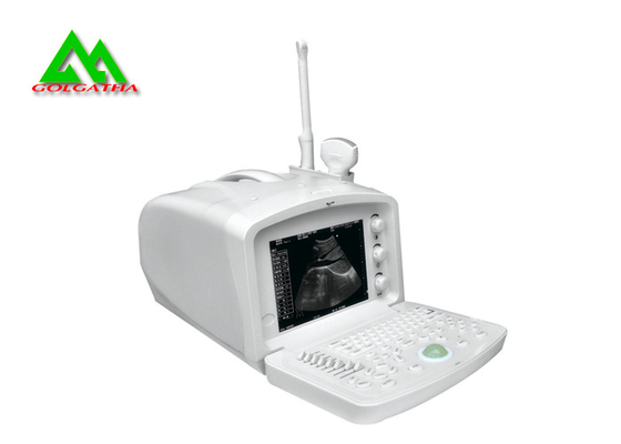 China Medizinische Ultraschall-Gerät-menschlicher Ultraschall-Scanner Digital mit LCD-Anzeige fournisseur